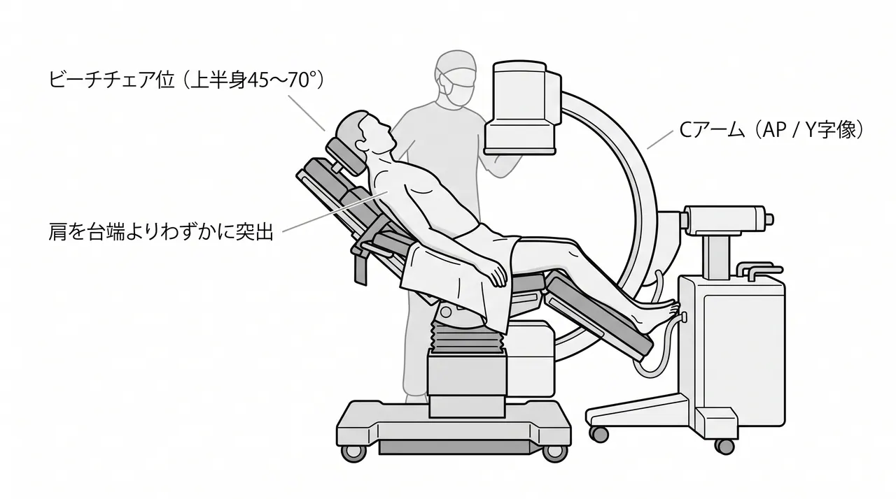 手術体位 — ビーチチェア位（半座位）のセットアップ