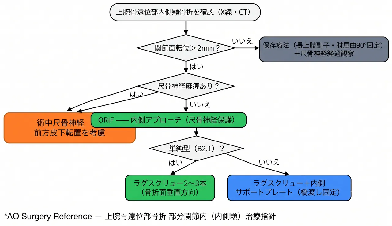 治療選択アルゴリズム（内側顆骨折）— 転位量評価→ORIF（ラグスクリュー＋内側プレート）→尺骨神経対応