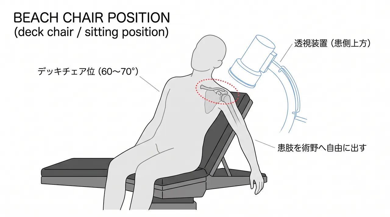 手術体位 — デッキチェア位（beach chair position）