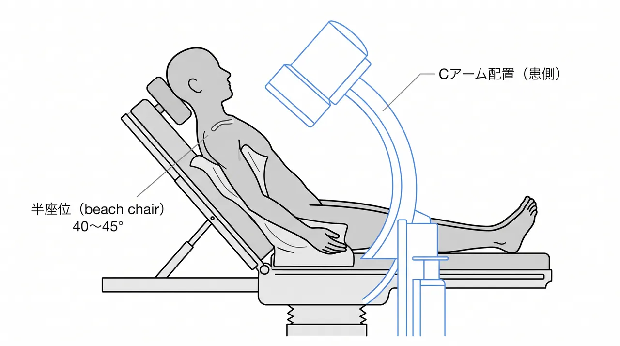 手術体位 — beach chair（半座位）セットアップ