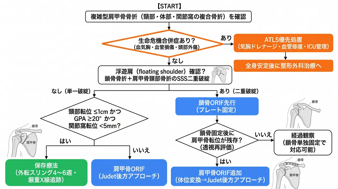 治療選択アルゴリズム — SSSC破綻評価→保存/鎖骨単独ORIF/両骨格同時ORIFの選択