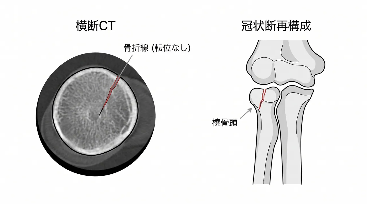 21-a1-ct-axial.png
