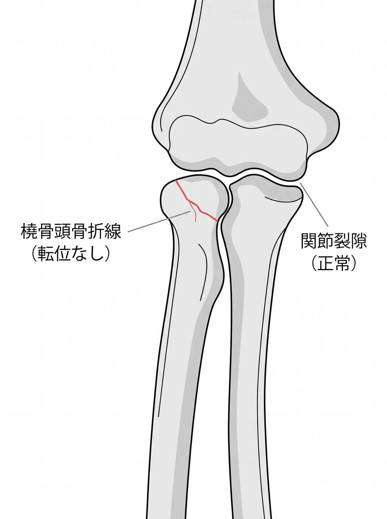 21-a1-xray-ap.png