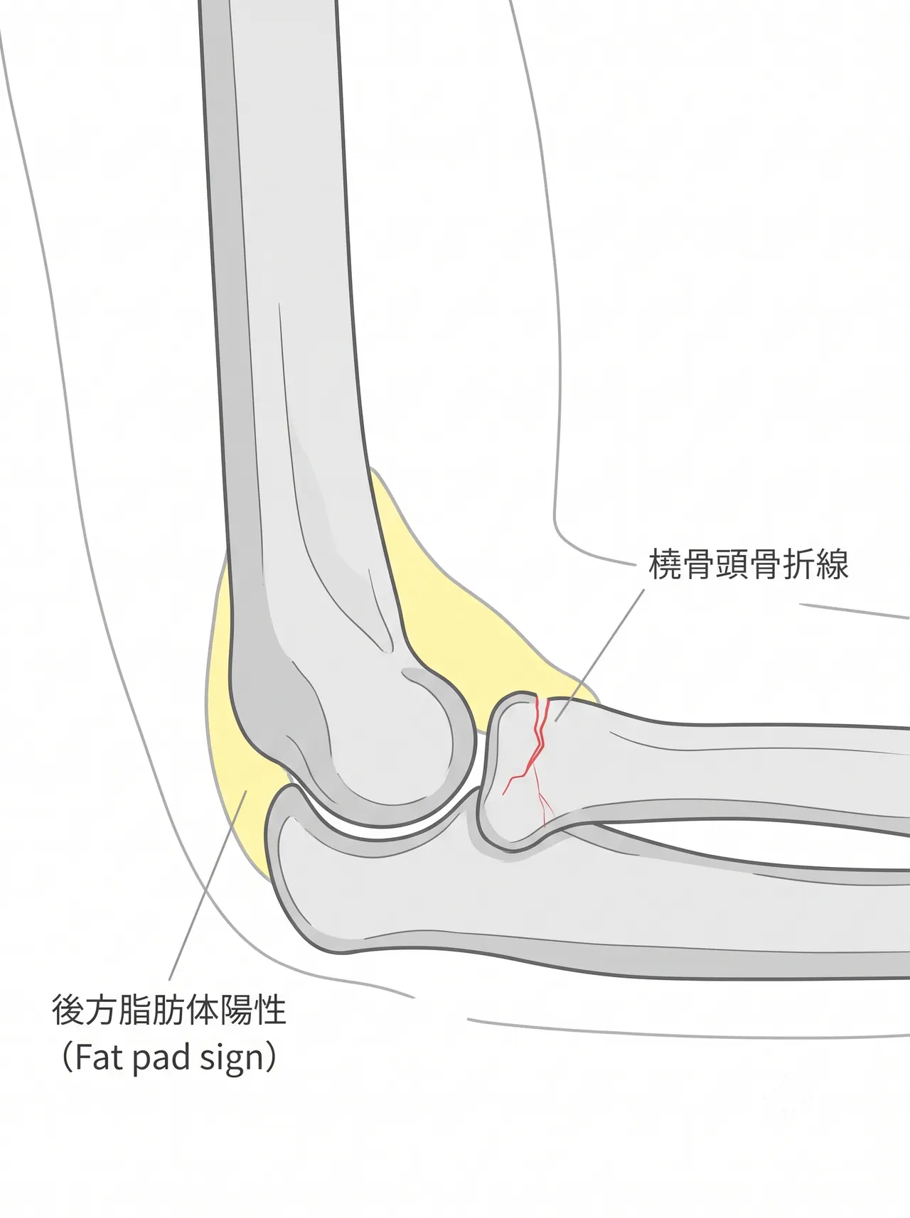21-a1-xray-lateral.png