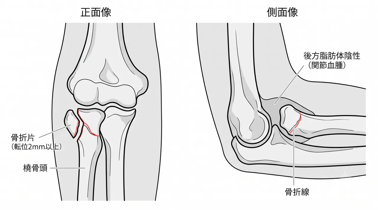 21-a2-xray.png
