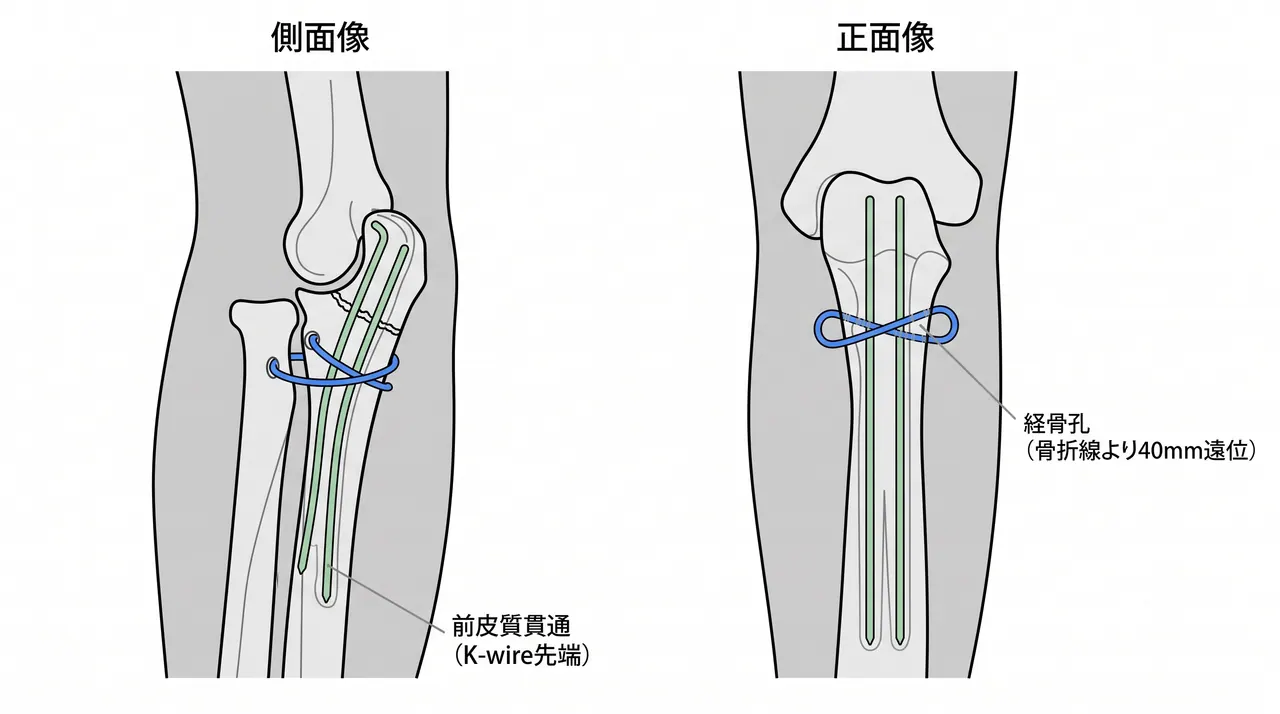 21-b1-fluoroscopy.png