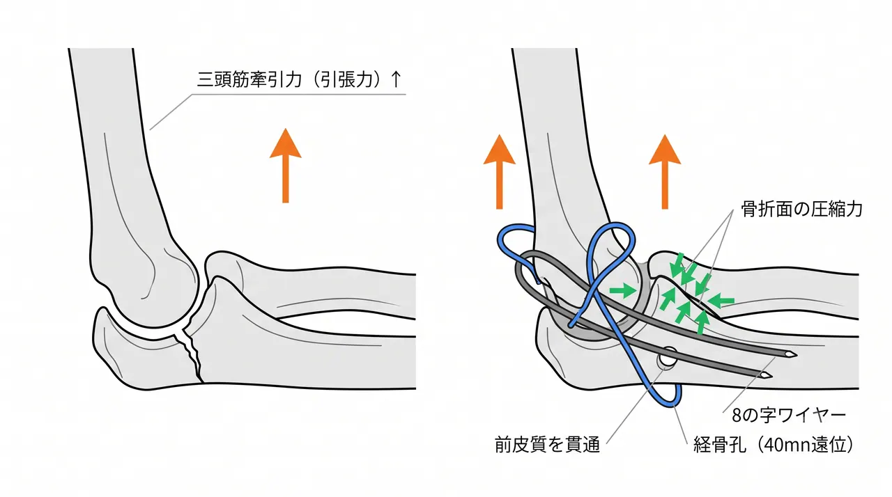 21-b1-tbw-biomechanics.png