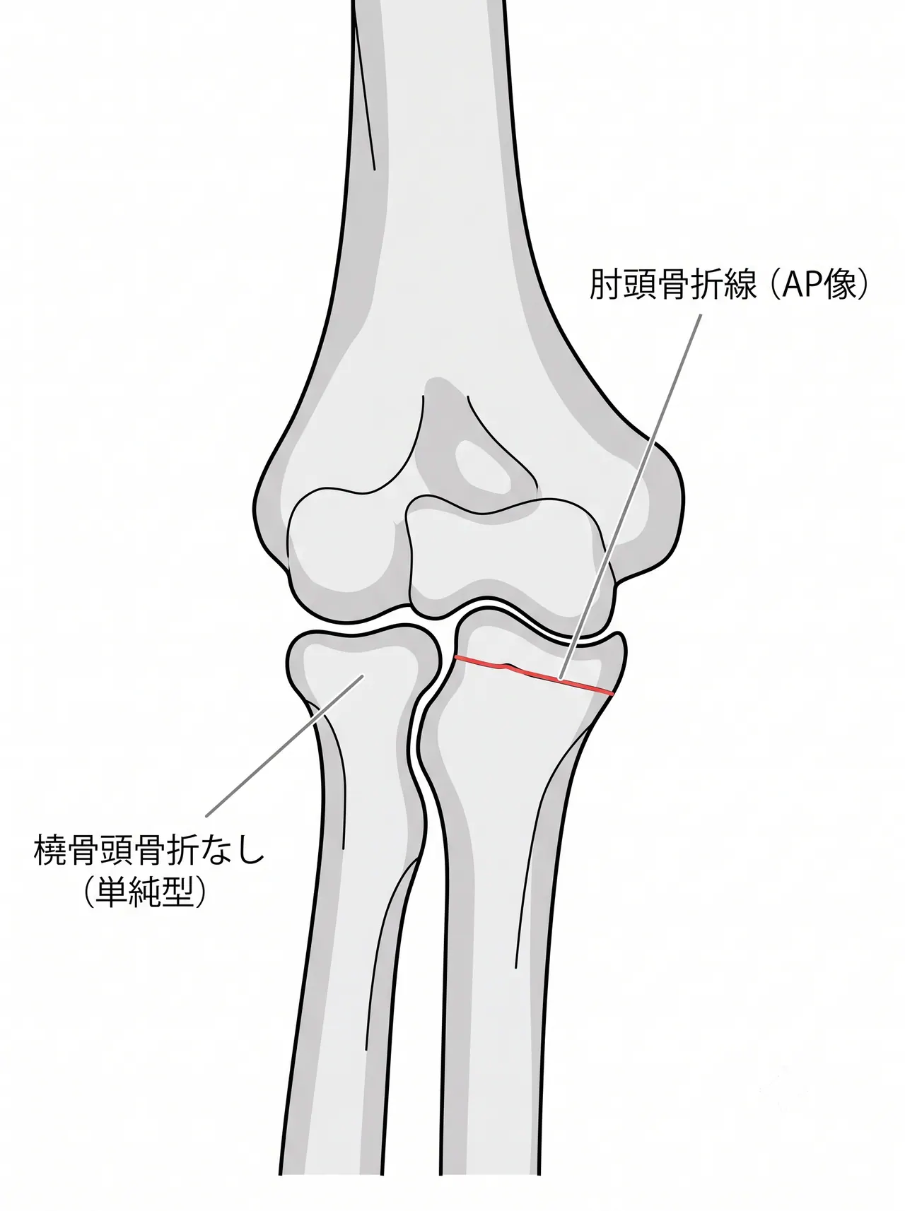 21-b1-xray-ap.png