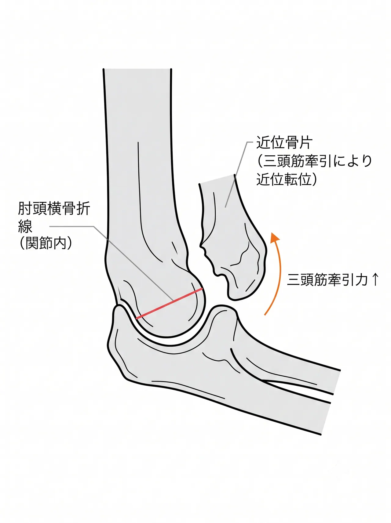 21-b1-xray-lateral.png