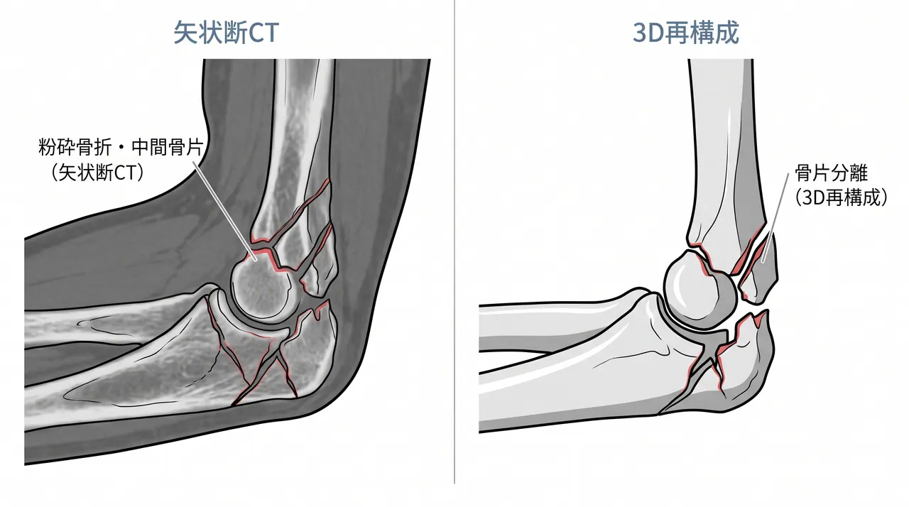 21-b2-ct-sagittal.png