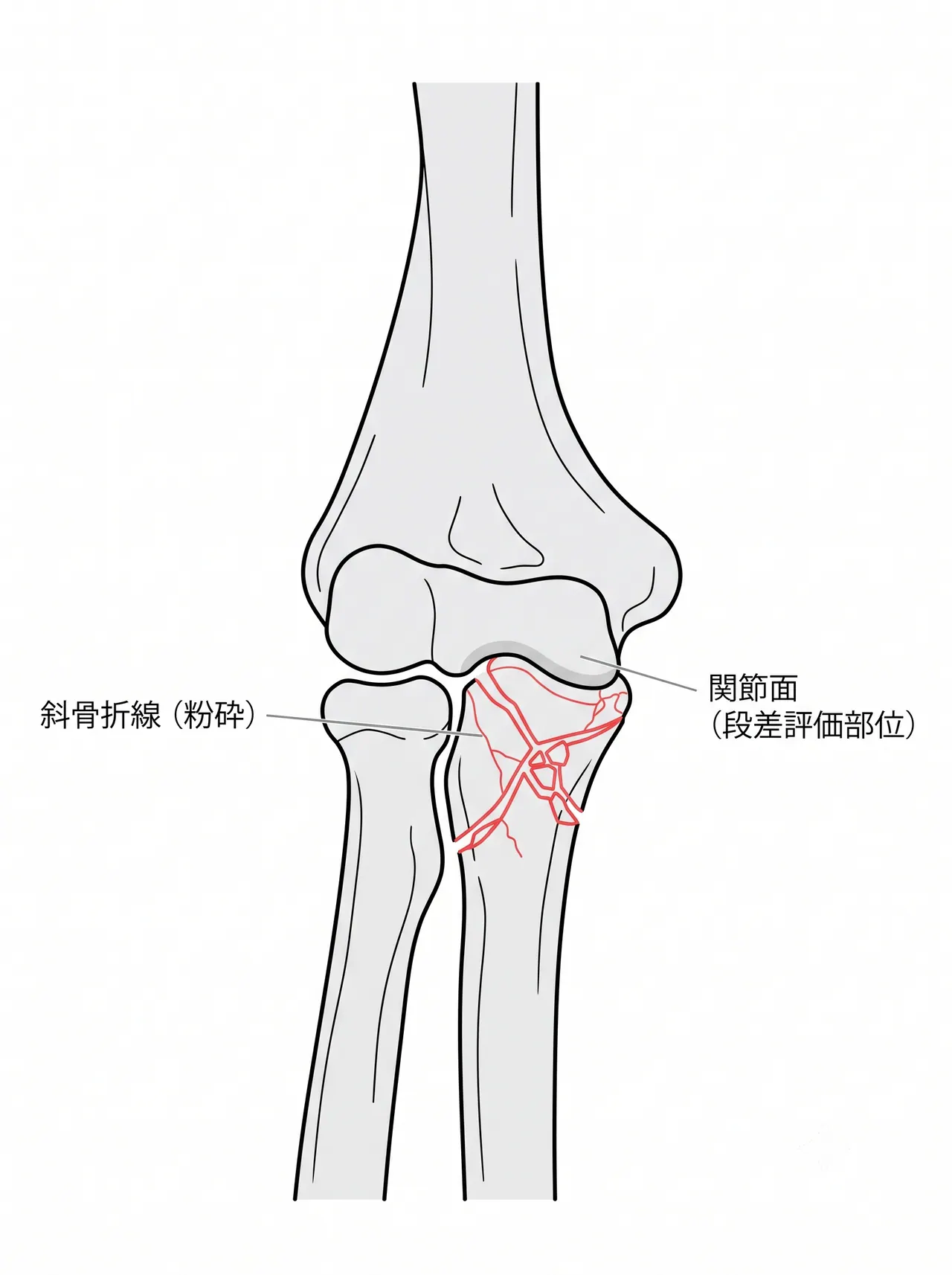 21-b2-xray-ap.png