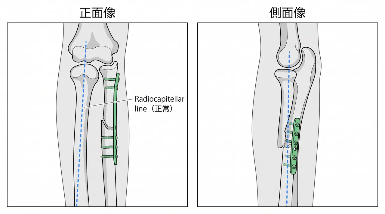 21-b3-fluoroscopy.png