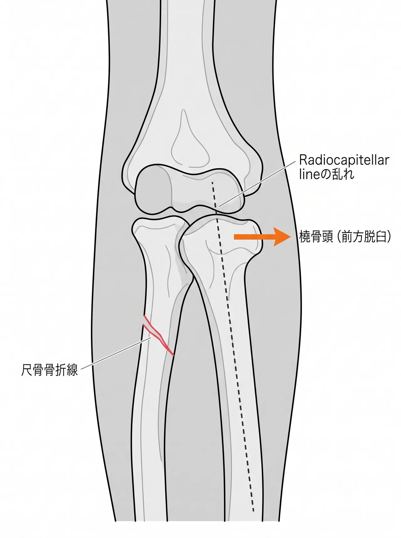 21-b3-xray-ap.png