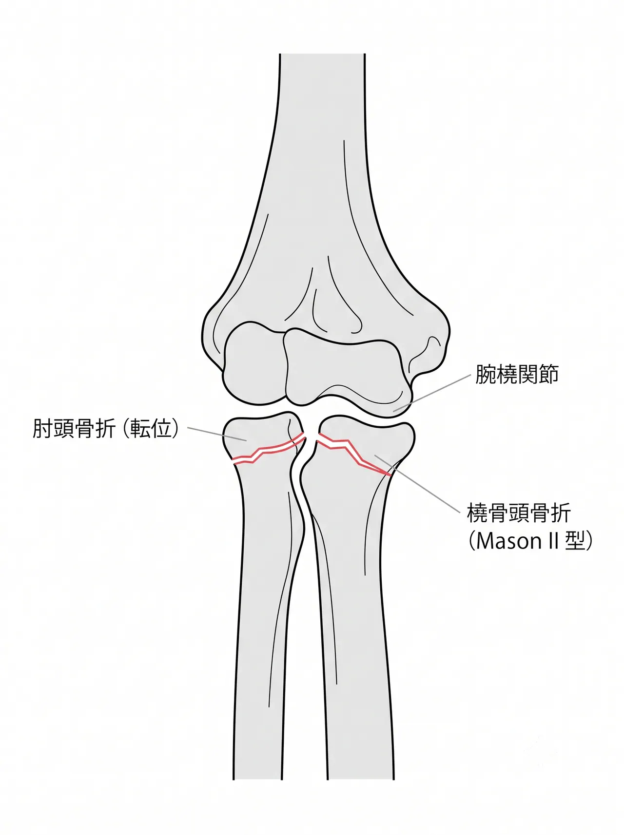 21-c1-xray-ap.png