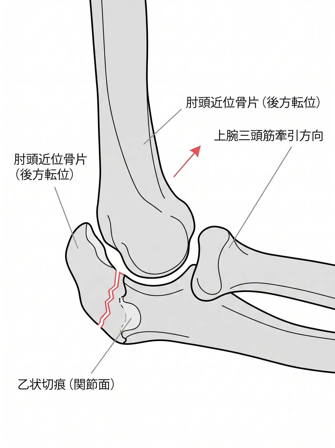 21-c1-xray-lateral.png