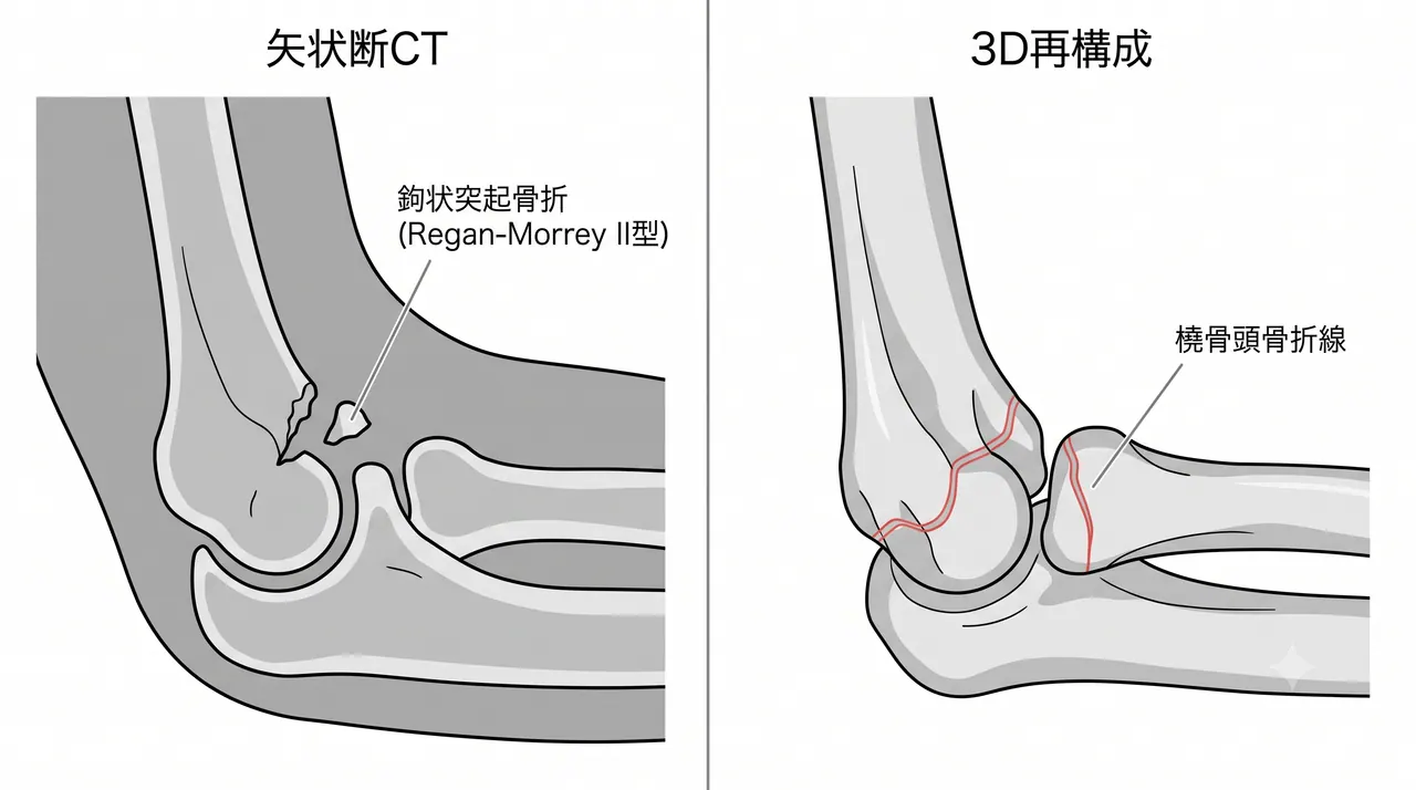 21-c3-ct-sagittal.png