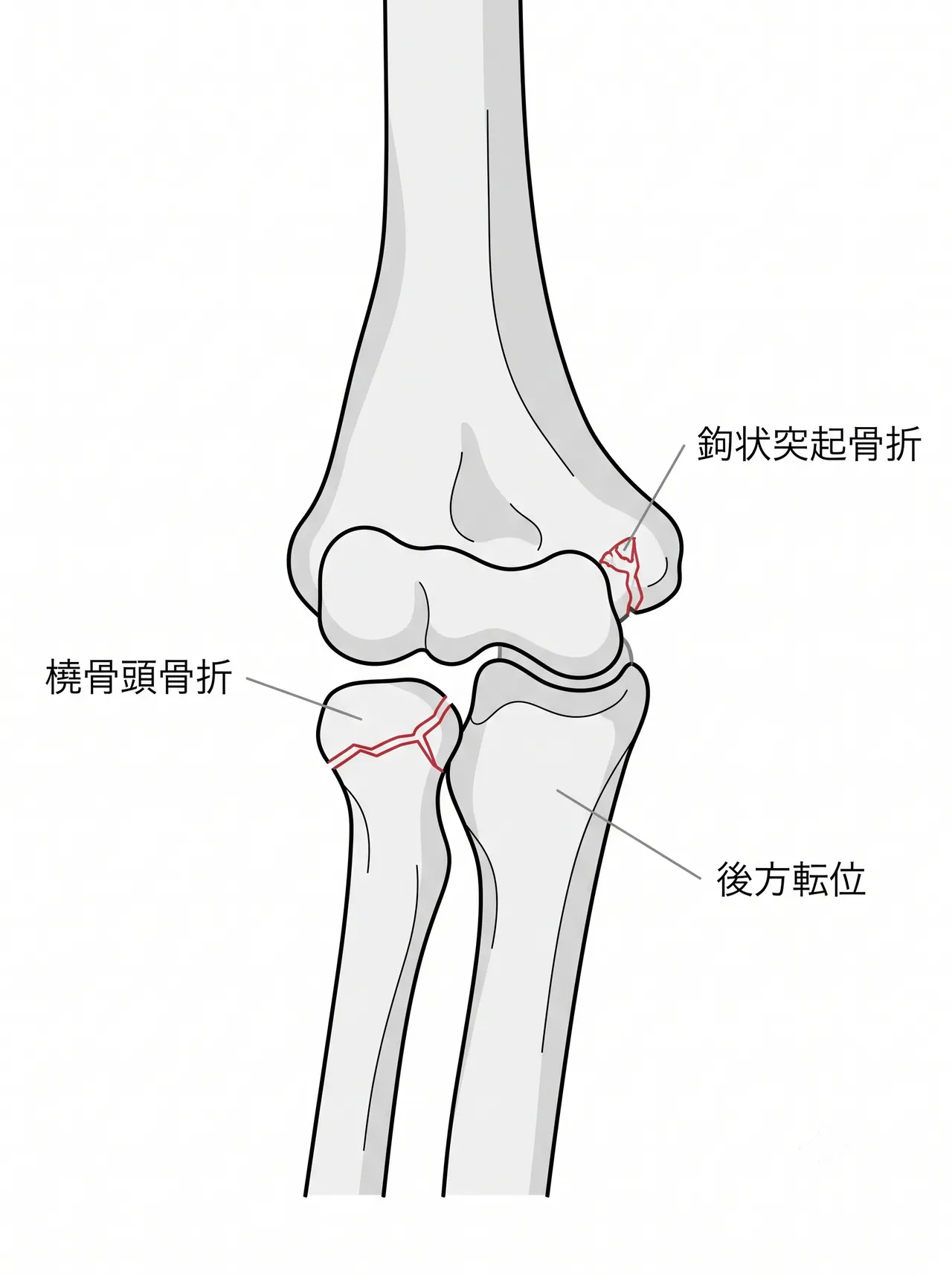 21-c3-xray-ap.png