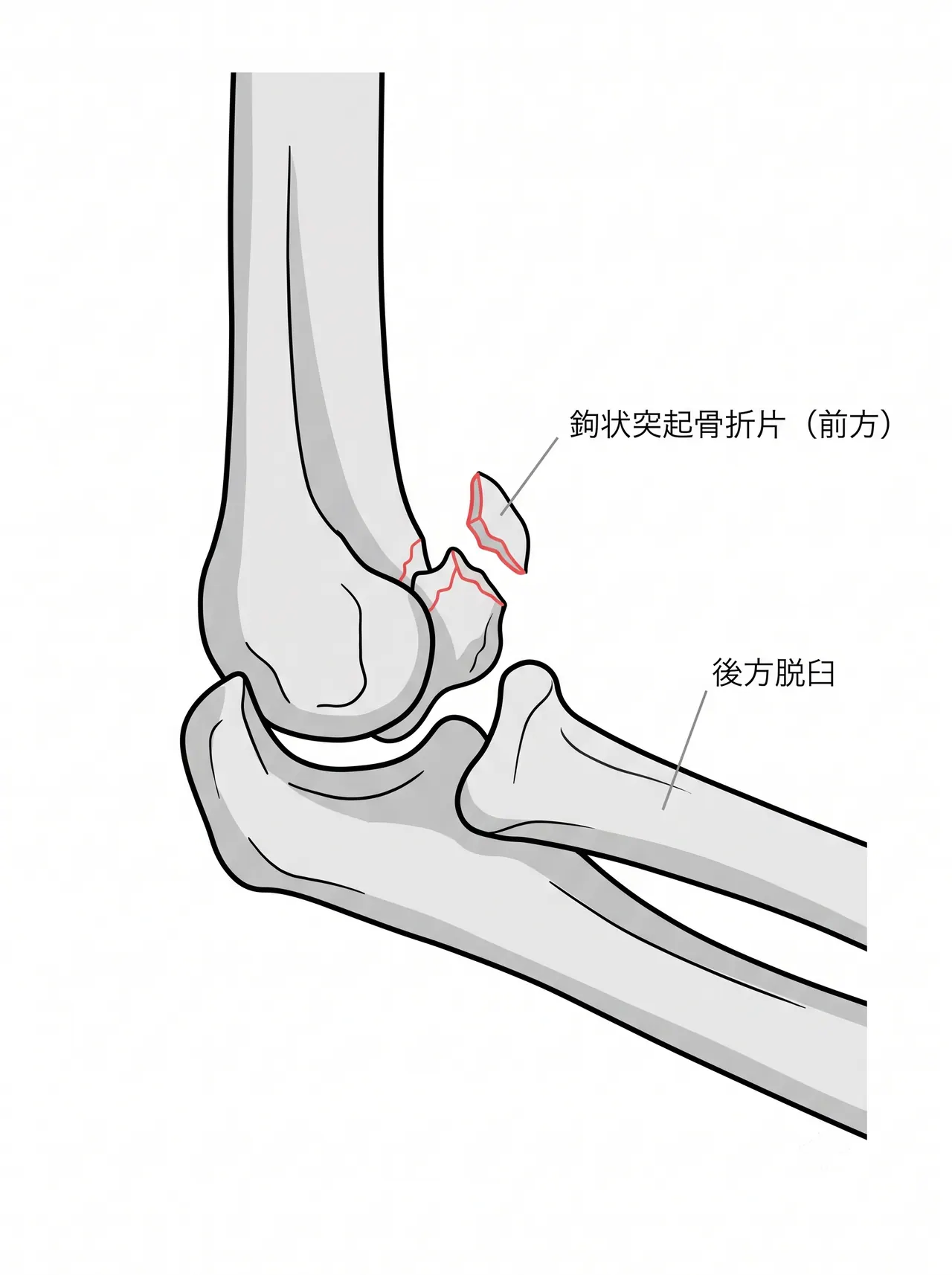 21-c3-xray-lateral.png
