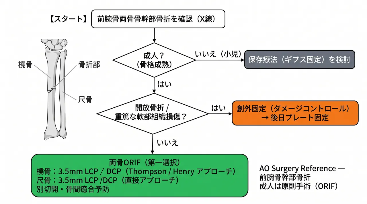治療選択アルゴリズム — 両骨ORIF（第一選択）vs 創外固定 vs 保存療法