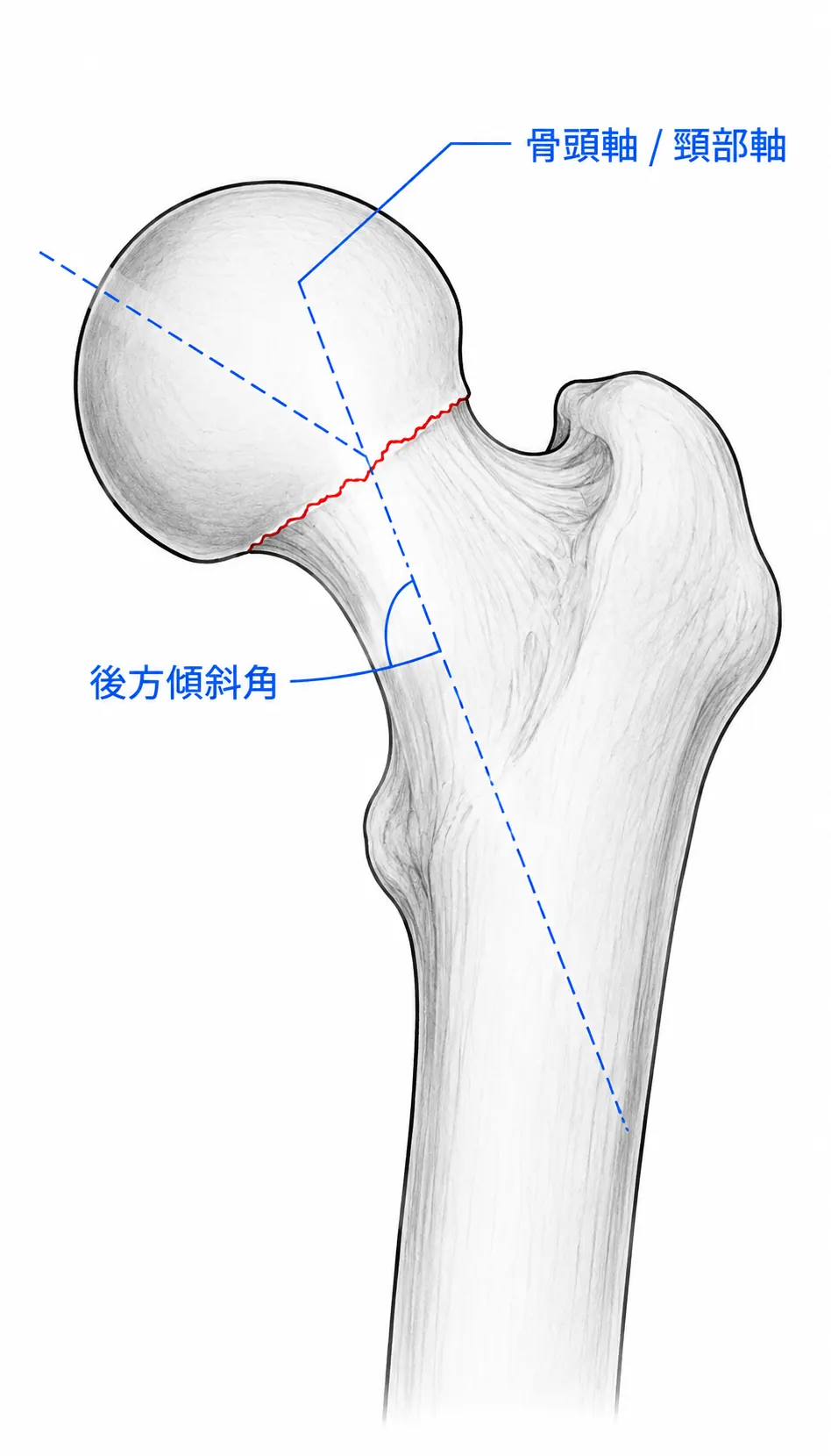 X線側面像 — 後方傾斜角の評価