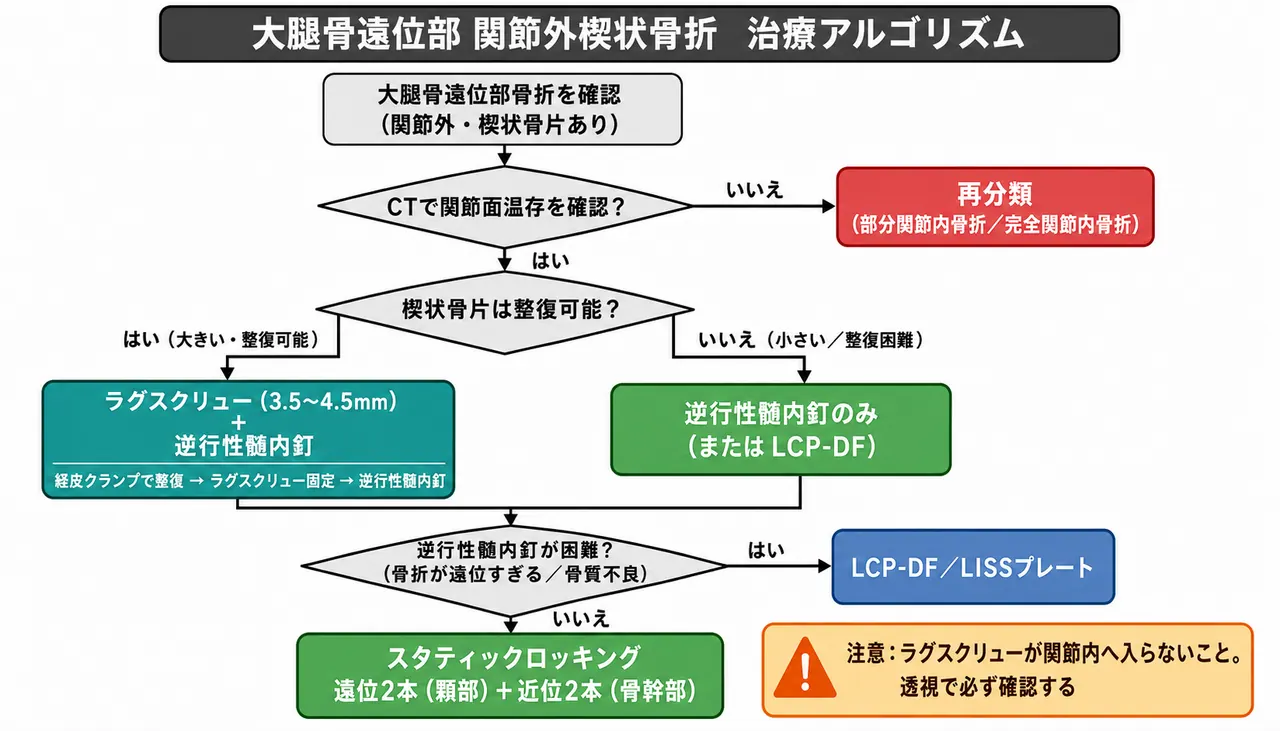 治療選択アルゴリズム — 楔状型・逆行性IM釘＋ラグスクリュー