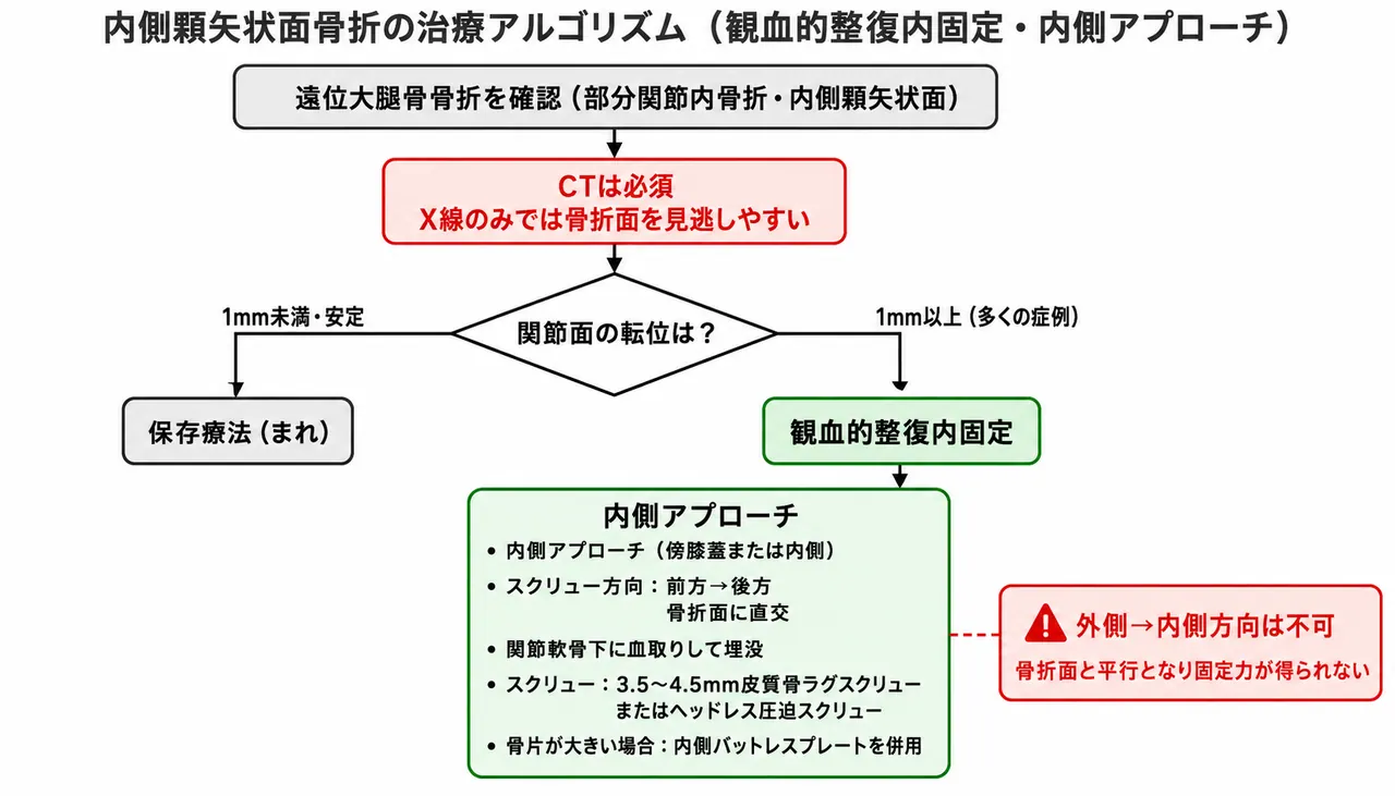 治療選択アルゴリズム — 内側顆矢状面骨折・ORIF・M→L方向（内側→外側）スクリュー（内側アプローチ）