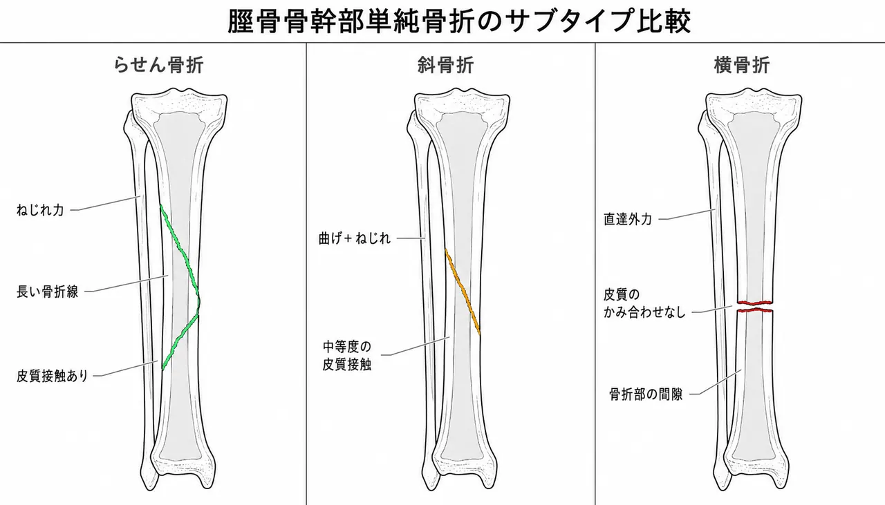 骨折パターン比較 — 42-A1（螺旋）vs 42-A2（斜骨折）vs 42-A3（横骨折）