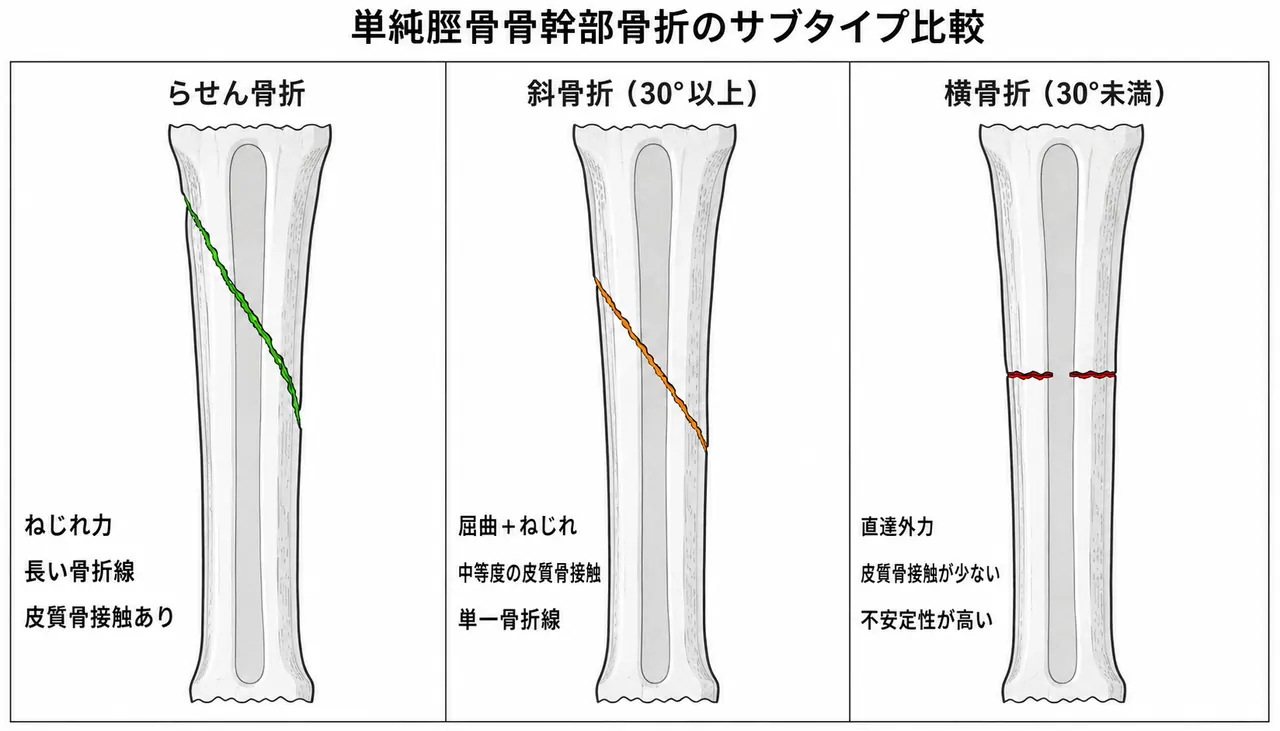 骨折パターン比較 — 42-A1（螺旋）vs 42-A2（斜骨折）vs 42-A3（横骨折）