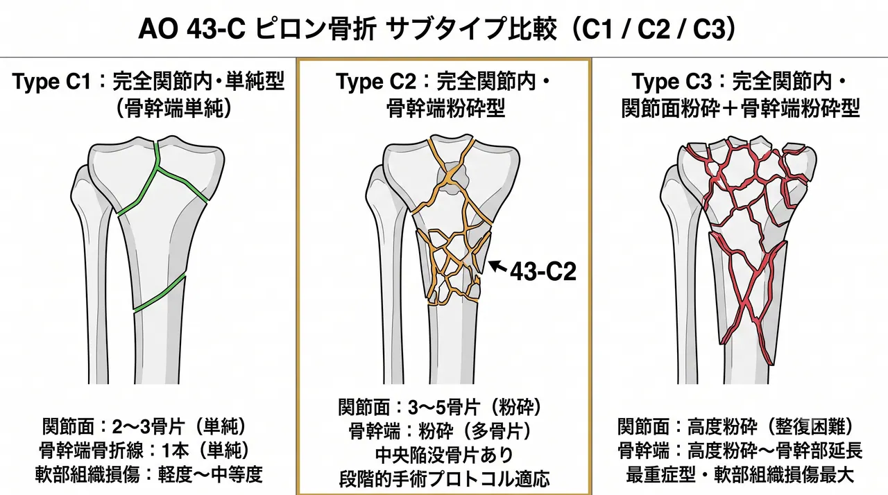 43-C1（単純骨幹端）vs 43-C2（粉砕骨幹端）vs 43-C3（粉砕関節面＋粉砕骨幹端）骨折パターン比較