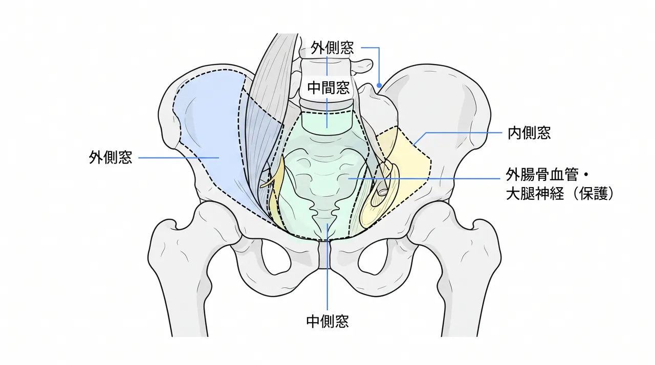 腸骨鼠径アプローチ解剖図 — 3つのウィンドウ（外側・中間・内側）と神経血管構造