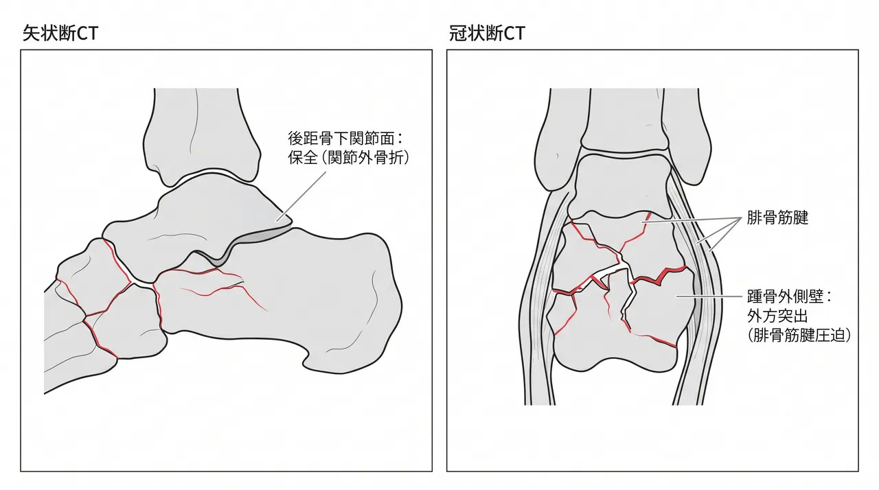 71-a2-ct-sagittal-coronal.png