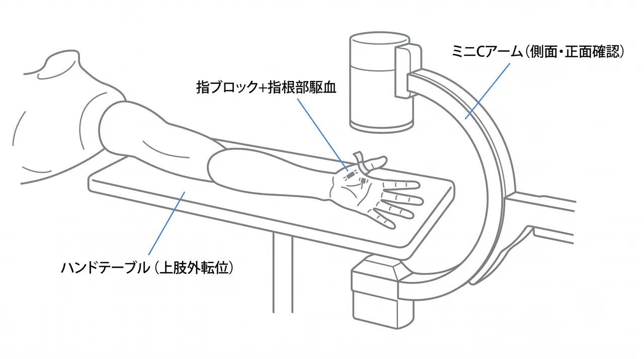 手術体位・透視セットアップ