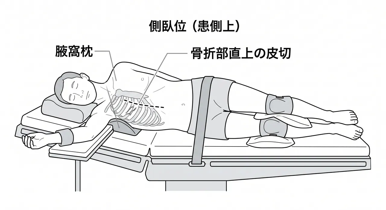 手術体位・手術台セットアップ（側臥位）