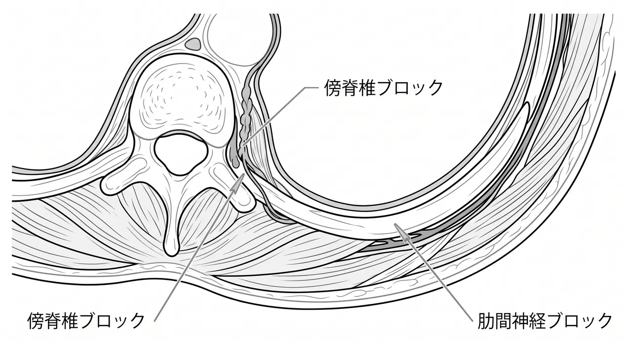 体位・皮膚切開 — 骨折部位（前方/外側/後方）に応じたアプローチ選択