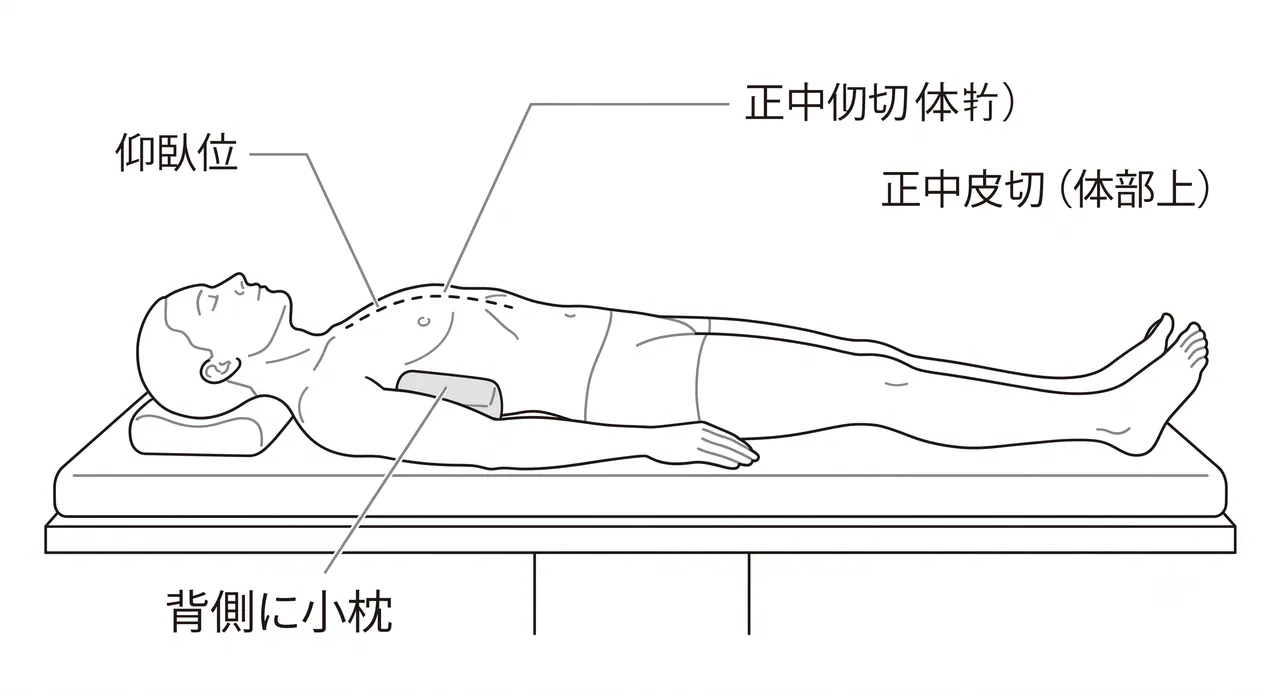 手術体位 — 仰臥位、上肢体側、前胸部を広く展開