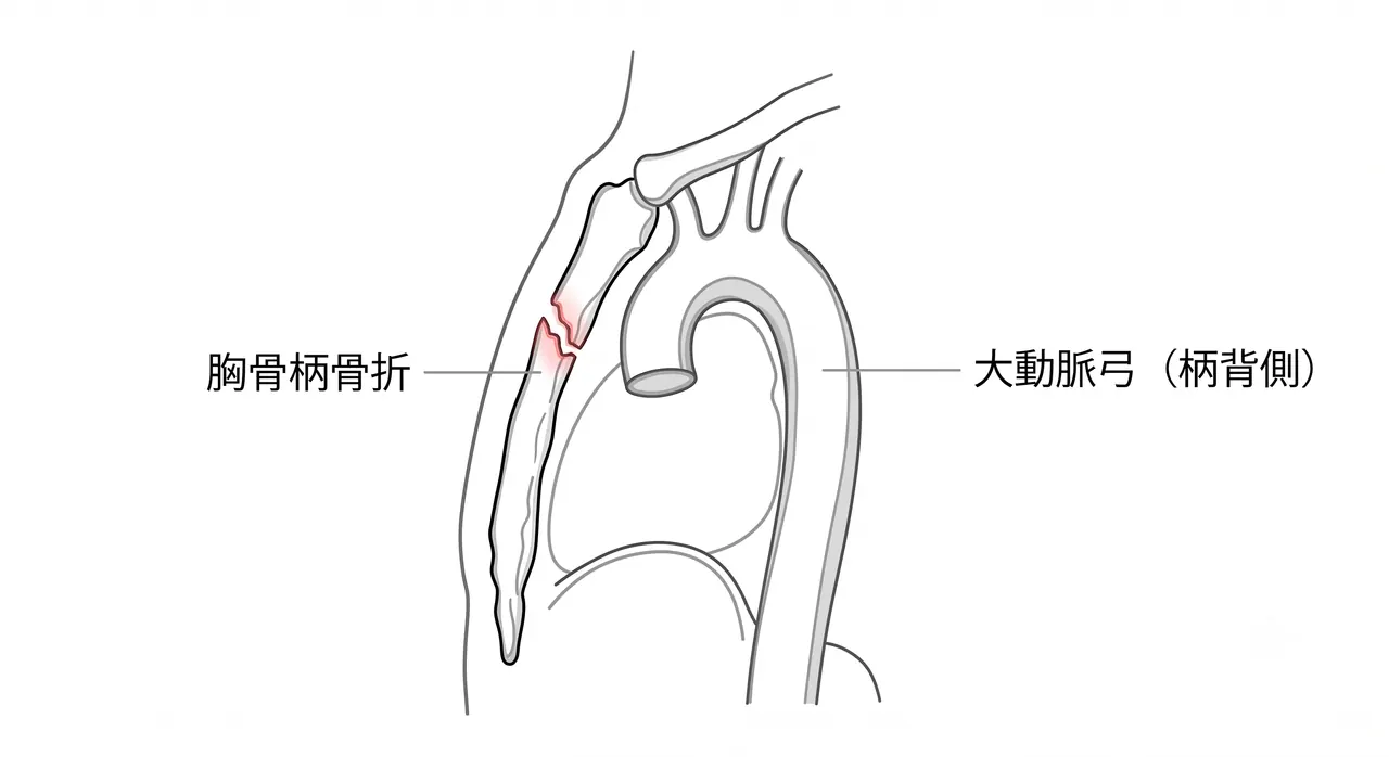 胸部CT矢状断 — 前後転位・柄体関節転位（Type I / II）の確認