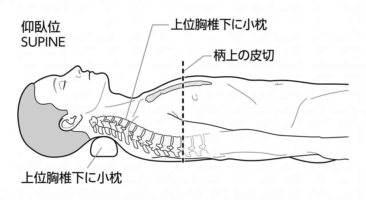 手術体位・皮切線 — 前胸部正中アプローチ