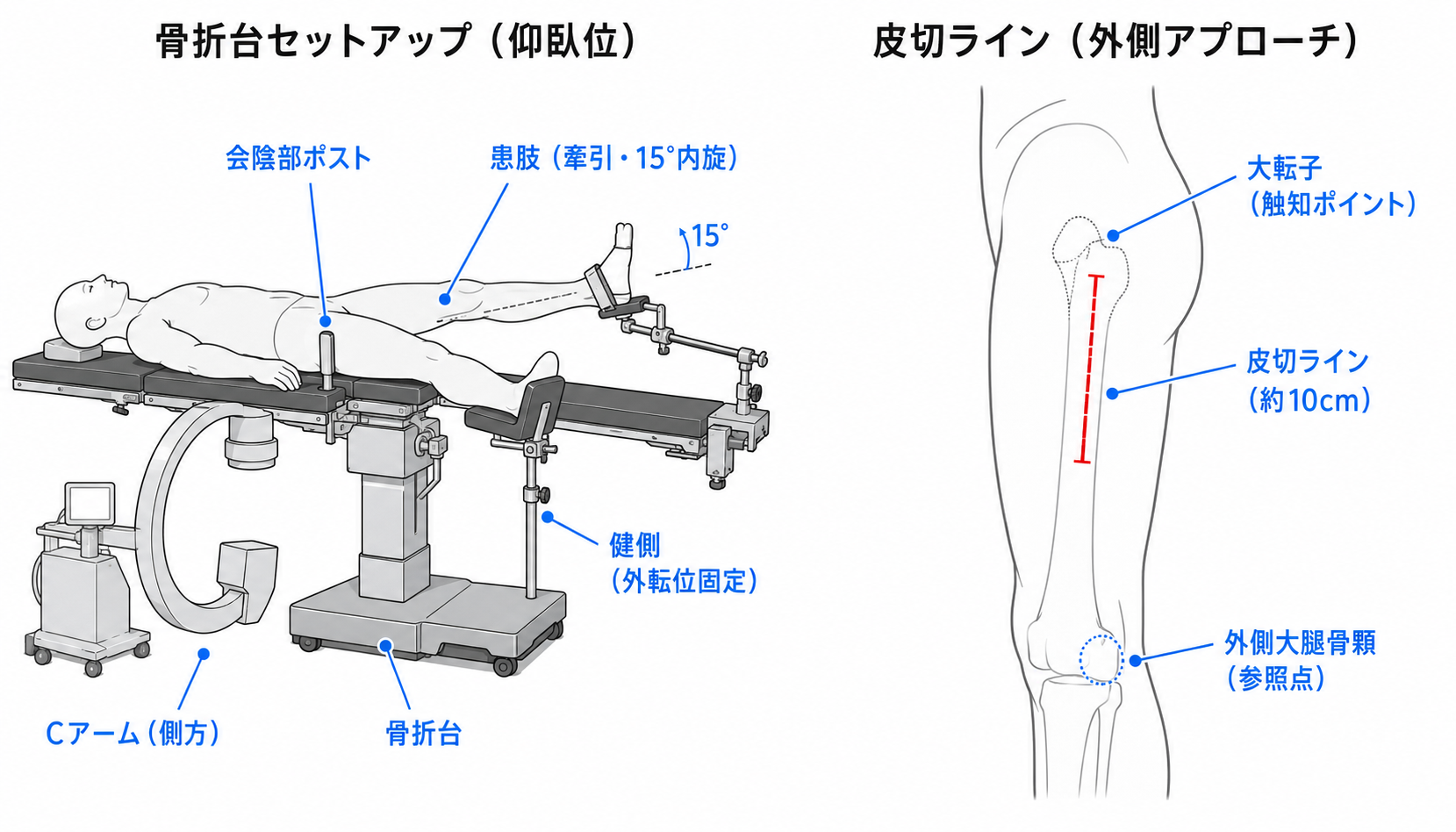 手術体位・手術台セットアップ