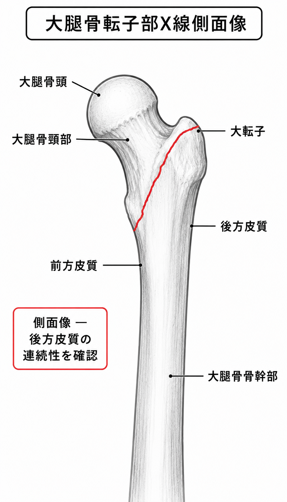 X線側面像 — 矢状面方向の転位評価